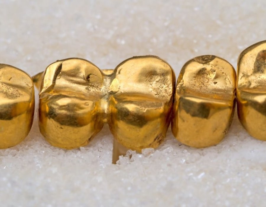 Золото коронки проба. Коронки 850 проба золотые. Золотые коронки 750 пробы. Золото 750 пробы в стоматологии. Золото 900 пробы в стоматологии.